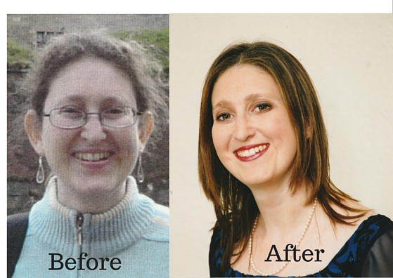 Before and After treatment